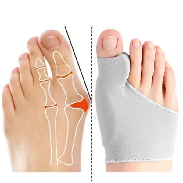 Toe Separator Hallux Valgus Bunion Corrector Orthotics Feet Bone Thumb Adjuster